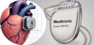 Pacemaker Implantation