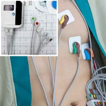 Holter Minitoring